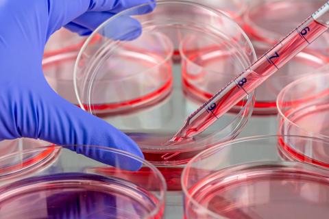Un tumore in bottiglia: ripensare i modelli cellulari